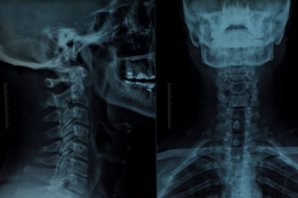 Radiografía de cabeza y parte superior de columna vertebral