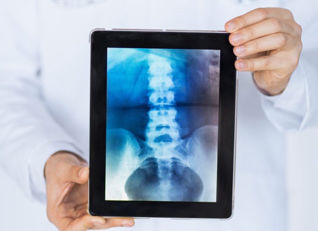 Visualización de radiografia en el departamento de teleradiología e imagenología