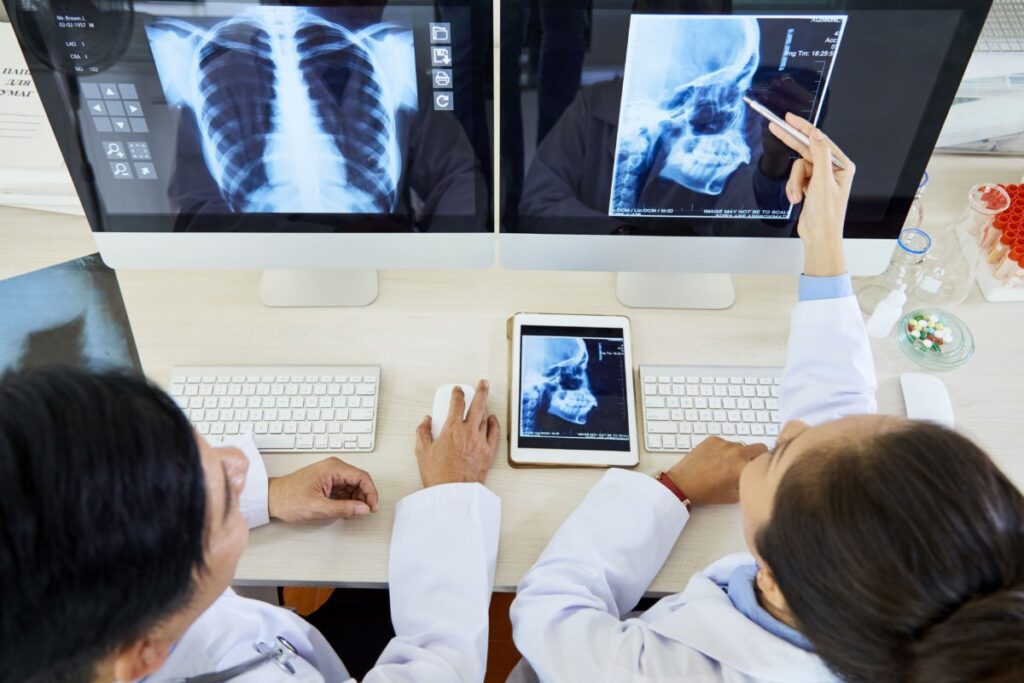 Visualización de radiografias en el departamento de teleradiología