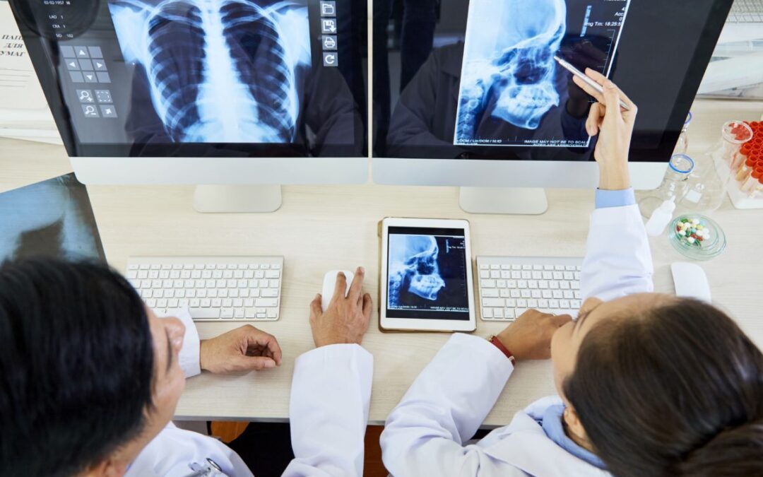 Visualización de radiografias en el departamento de teleradiología