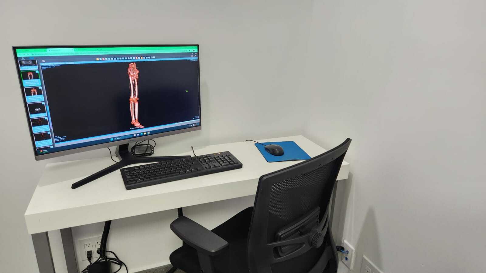 Estación de trabajo de Radiocare con monitor mostrando una imagen 3D del esqueleto humano