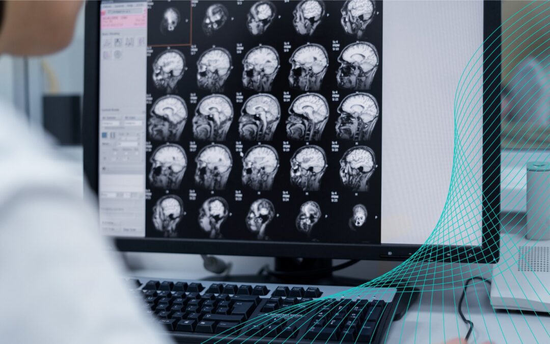 El impacto de la radiología en la salud cerebral